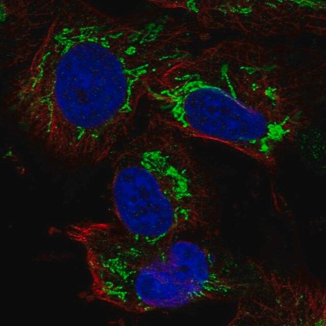 Anti-TFB2M antibody produced in rabbit