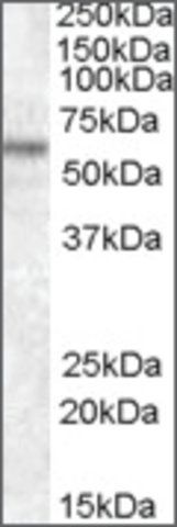 Anti-TFE3 (N-terminal) antibody produced in goat