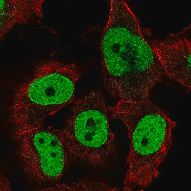 Anti-TFPT antibody produced in rabbit