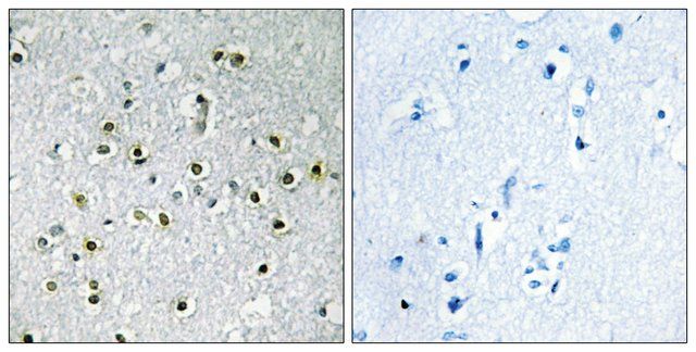 Anti-TFE3 antibody produced in rabbit