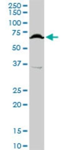 Anti-TFCP2 antibody produced in rabbit