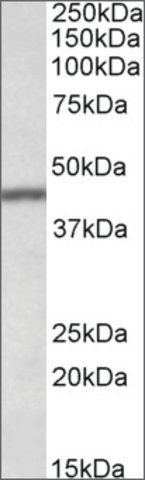 Anti-TFB2M antibody produced in goat