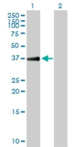 Anti-TGDS antibody produced in mouse