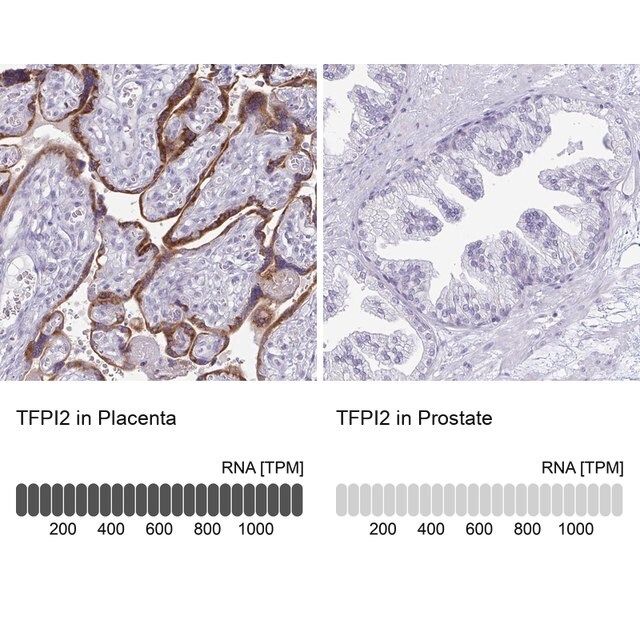 Anti-TFPI2 antibody produced in rabbit