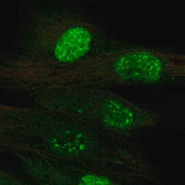 Anti-TERT antibody produced in rabbit