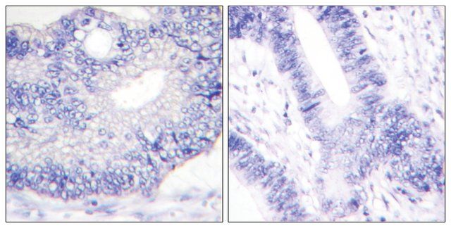 Anti-TGF  antibody produced in rabbit