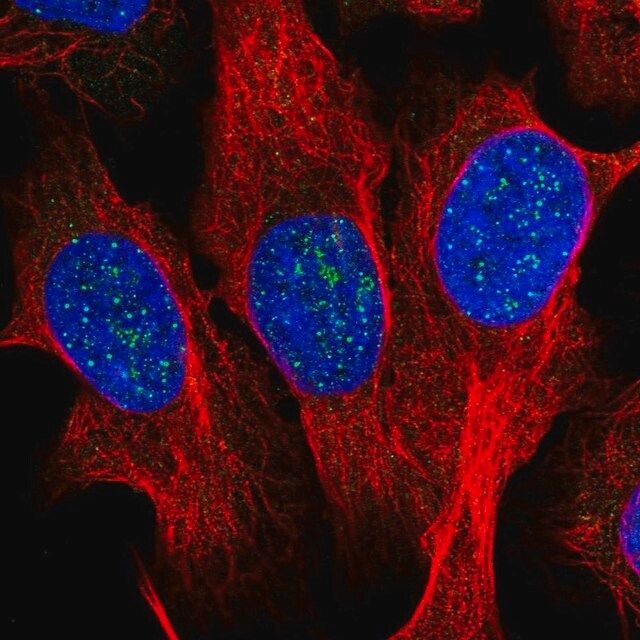 Anti-TERF1 antibody produced in rabbit