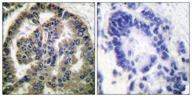 Anti-TGF 2, C-Terminal antibody produced in rabbit