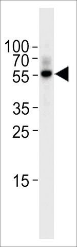 ANTI-TGF BETA 2(C-TERMINAL) antibody produced in rabbit