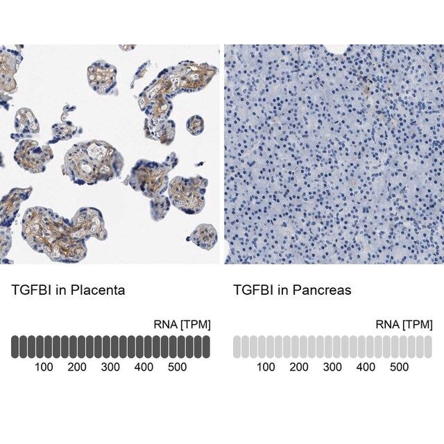 Anti-TGFBI antibody produced in rabbit