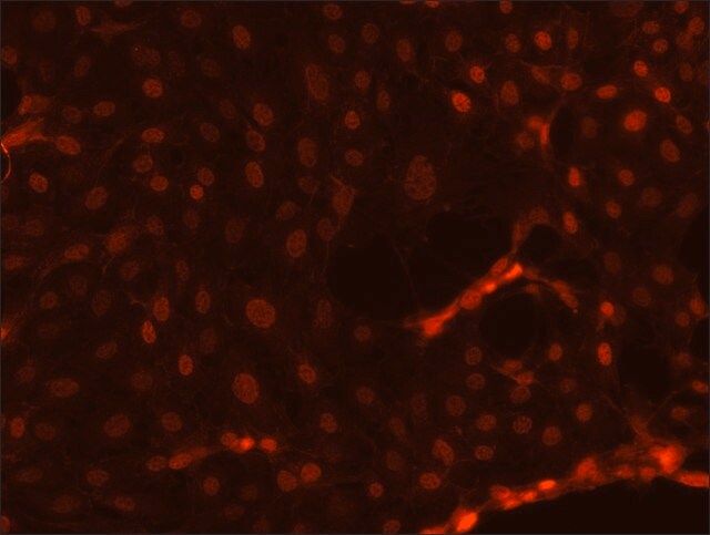 Anti-TFE3 antibody produced in rabbit