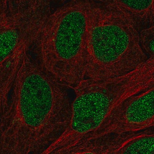 Anti-TFCP2 antibody produced in rabbit