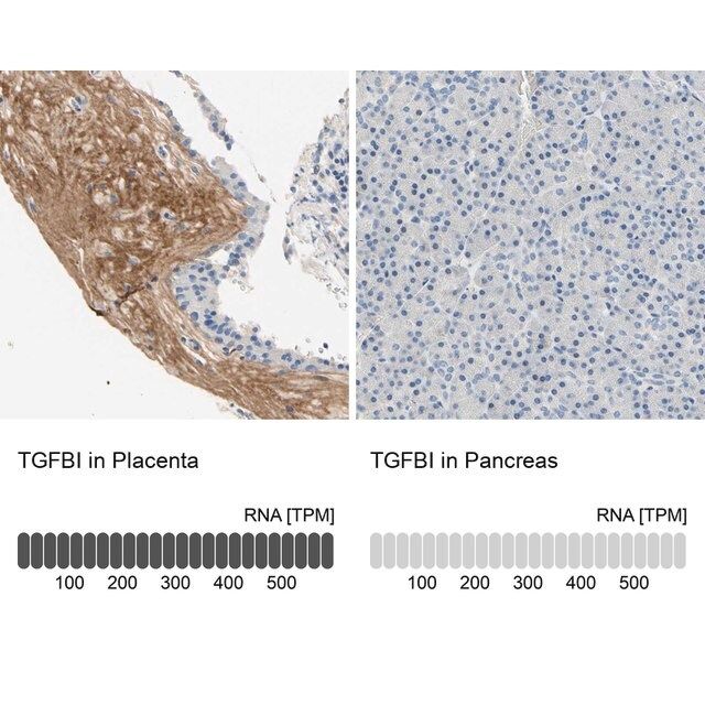 Anti-TGFBI antibody produced in rabbit