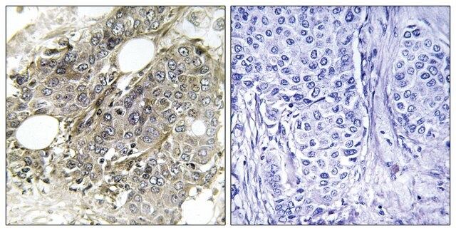 Anti-TGF  Receptor III, C-Terminal antibody produced in rabbit