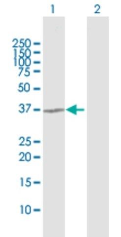 Anti-TGDS antibody produced in rabbit