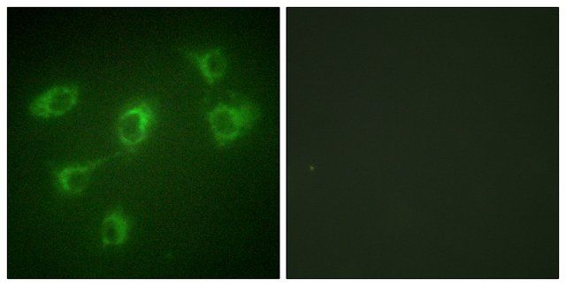 Anti-TGF  Receptor III antibody produced in rabbit