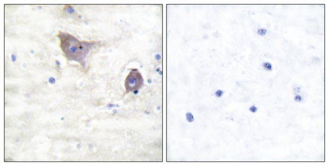 Anti-Synuclein  antibody produced in rabbit