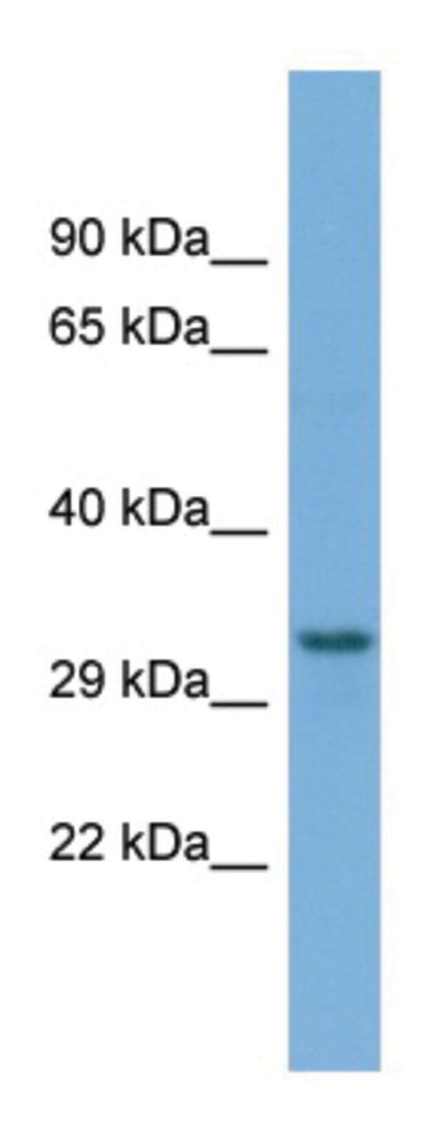 Anti-TAMM41 (C-terminal) antibody produced in rabbit