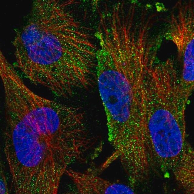 Anti-TAMM41 antibody produced in rabbit