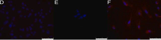 Anti-Stage-Specific Embryonic Antigen-1 Antibody, clone MC-480