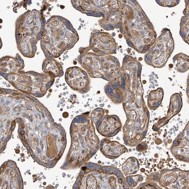 Anti-STARD4 antibody produced in rabbit