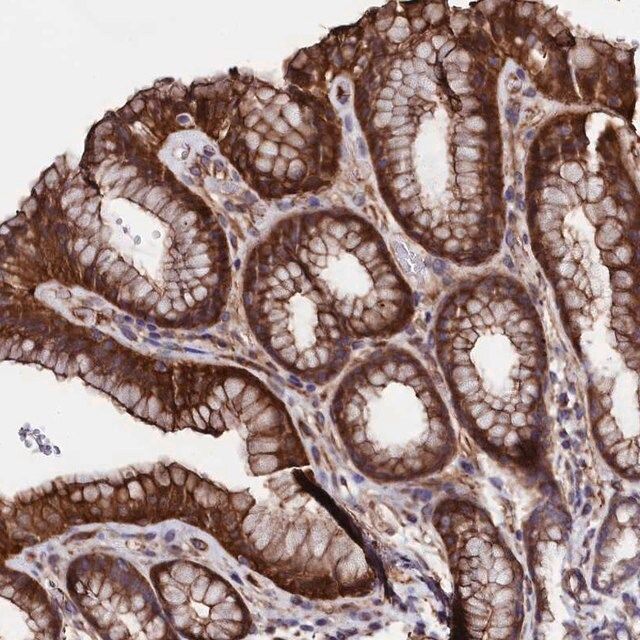 Anti-STAMBPL1 antibody produced in rabbit