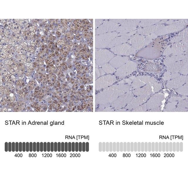 Anti-STAR antibody produced in rabbit