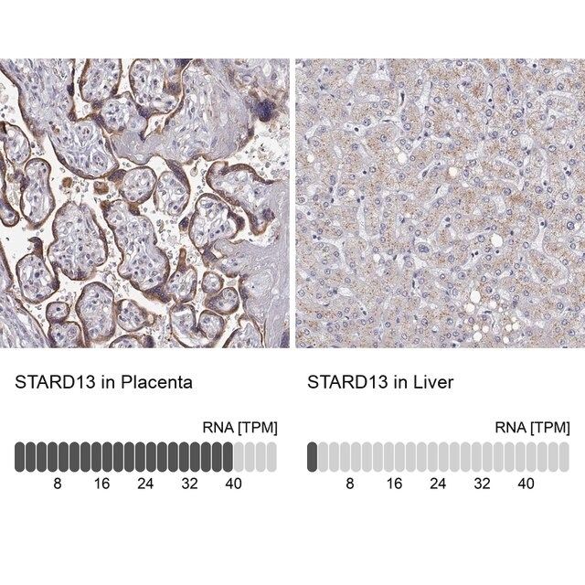 Anti-STARD13 antibody produced in rabbit