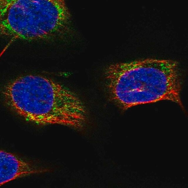 Anti-STARD7 antibody produced in rabbit