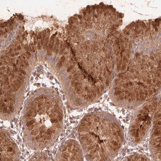 Anti-STARD7 antibody produced in rabbit