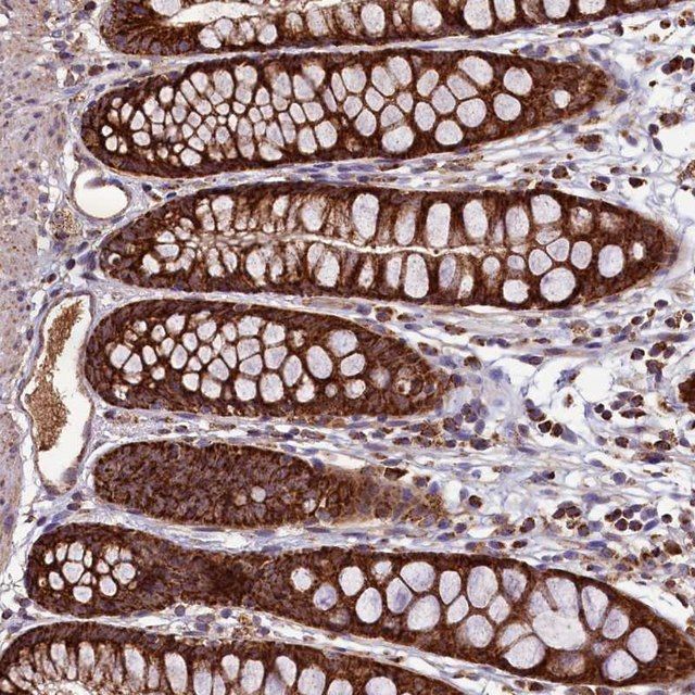 Anti-STARD5 antibody produced in rabbit