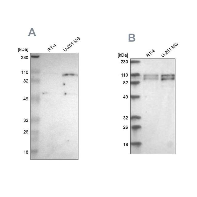 Anti-STRN3 antibody produced in rabbit