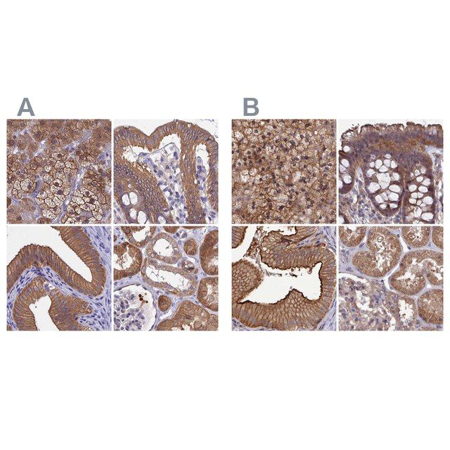 Anti-STUB1 antibody produced in rabbit