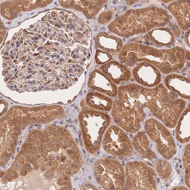 Anti-ST8SIA4 antibody produced in rabbit