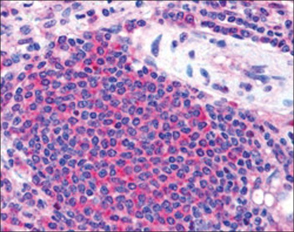 Anti-STS2/TULA (Internal) antibody produced in goat