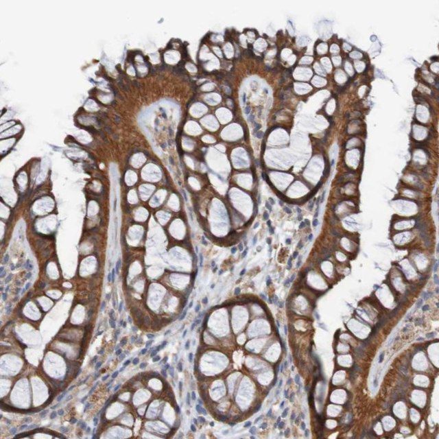 Anti-ST8SIA6 antibody produced in rabbit