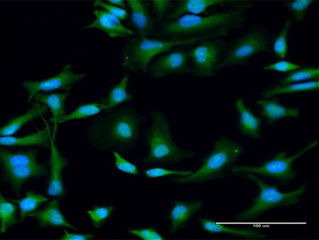 Anti-STX11 antibody produced in rabbit