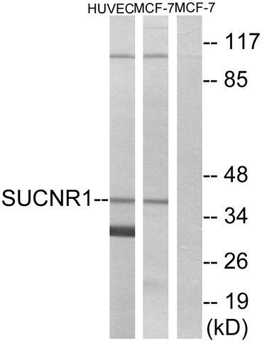 Anti-SUCNR1 antibody produced in rabbit