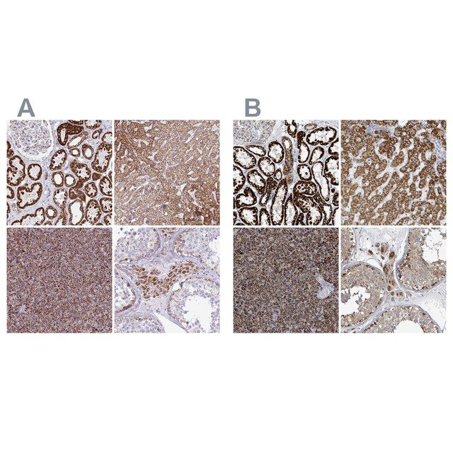 Anti-SUCLG2 antibody produced in rabbit