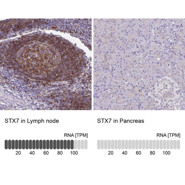 Anti-STX7 antibody produced in rabbit