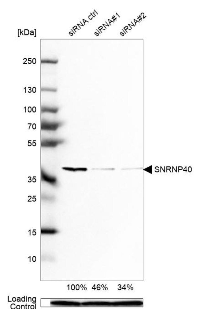 Anti-SNRNP40 antibody produced in rabbit