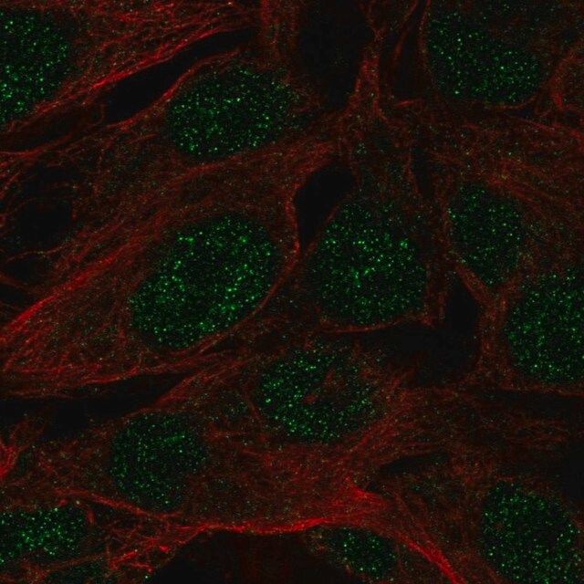 Anti-SPATS1 antibody produced in rabbit