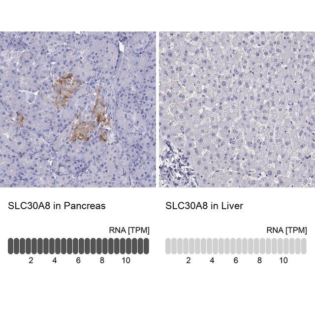 Anti-SLC30A8