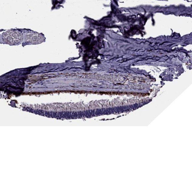 Anti-SLC16A8 antibody produced in rabbit