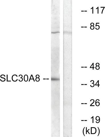 Anti-SLC30A8 antibody produced in rabbit