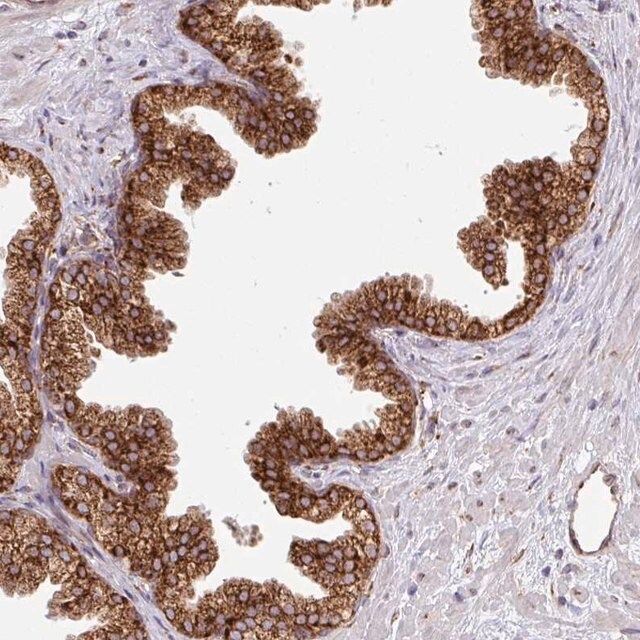 Anti-SLC39A7 antibody produced in rabbit