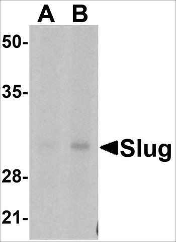 Anti-Slug (ab1) antibody produced in rabbit