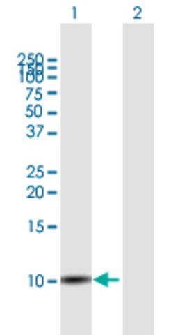 Anti-SLURP1 antibody produced in mouse