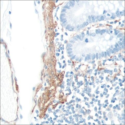 Anti-SMA antibody, Rabbit monoclonal