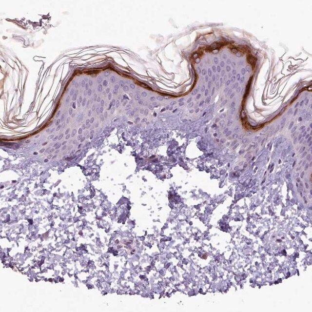 Anti-SLURP1 antibody produced in rabbit